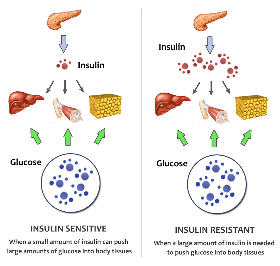 resistencia insulina 0
