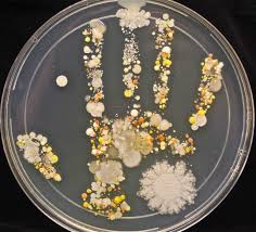 bacterias en la mano