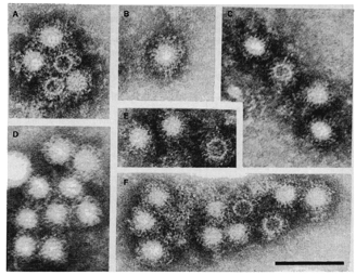 historia VHC virus