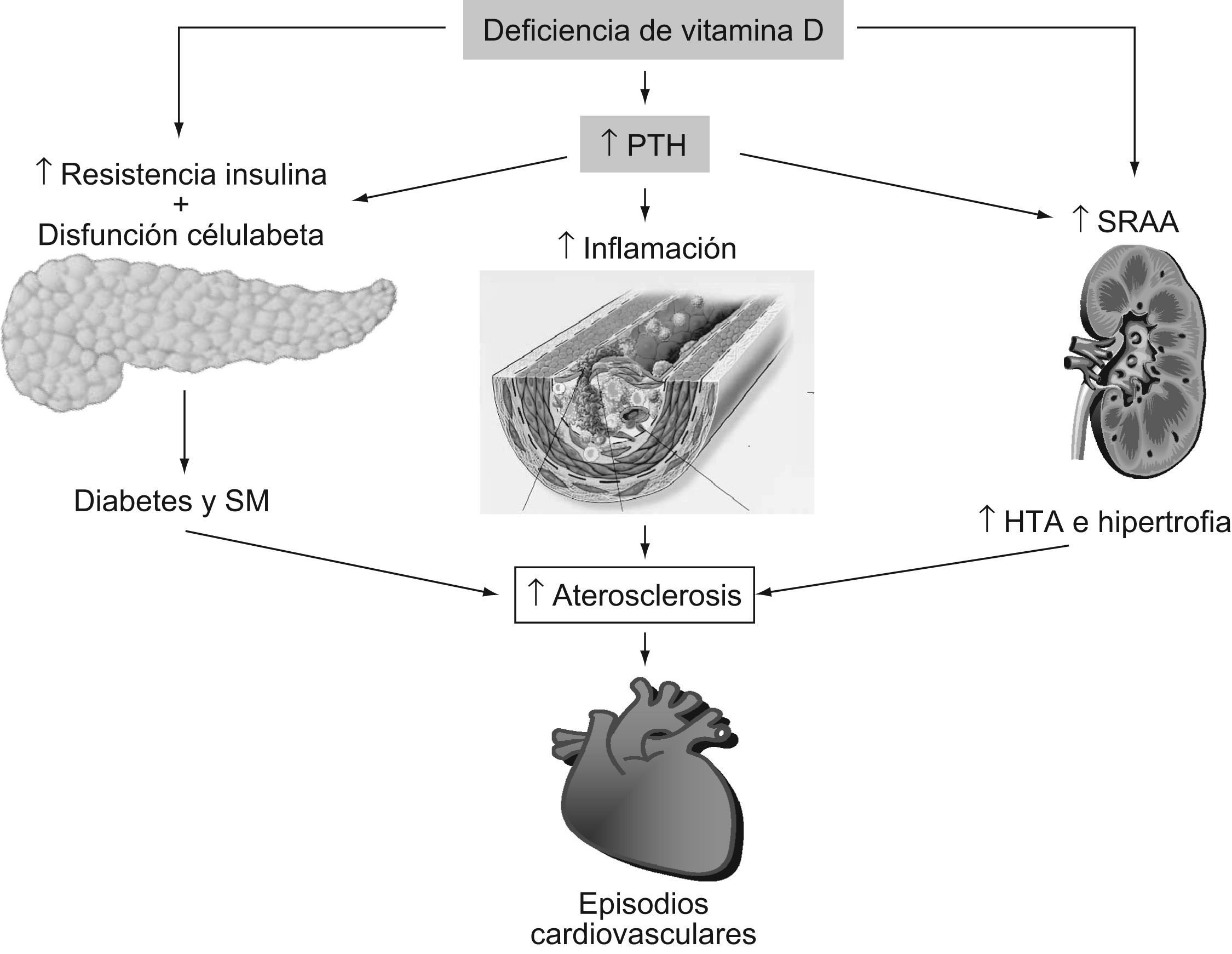 vitD cardiovascular